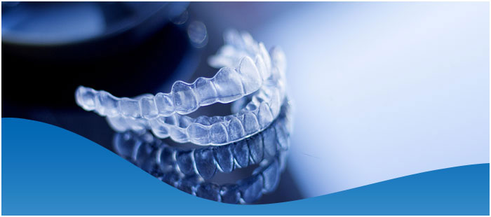 How Much Does Invisalign Cost in Dallas, TX