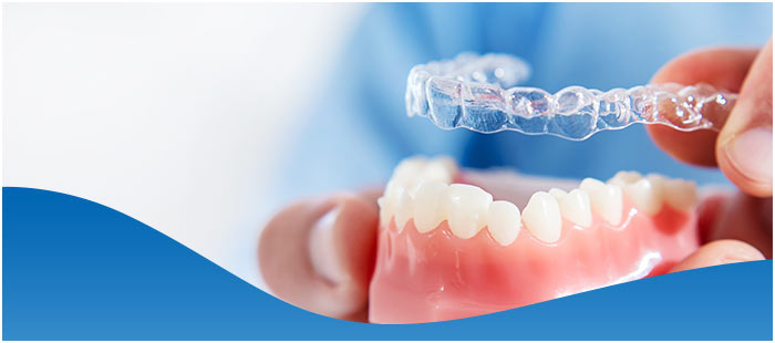 How Much Does Invisalign Cost in Redwood City?