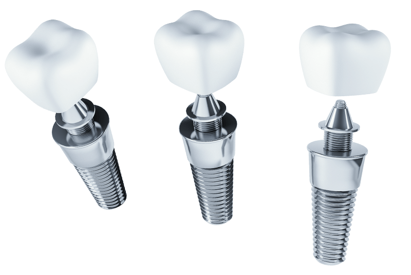 dental implants transparent
